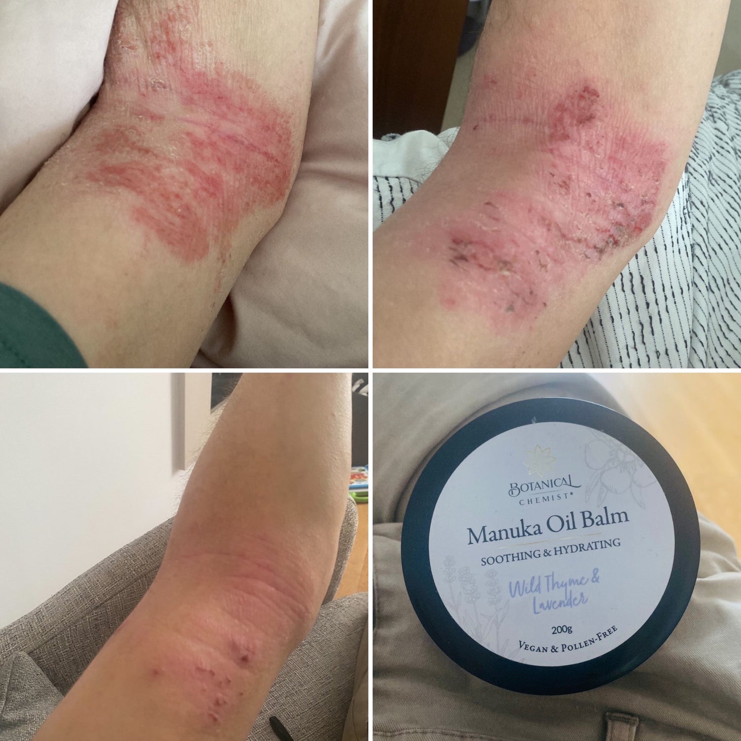 DermaGen Manuka Balm - Your