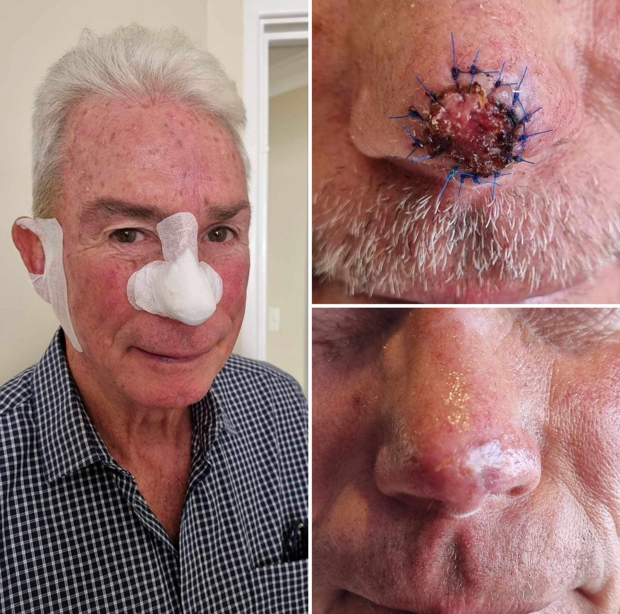 Propolis Balm - with Antiseptic, Anti-inflammatory, and Antioxidant Properties