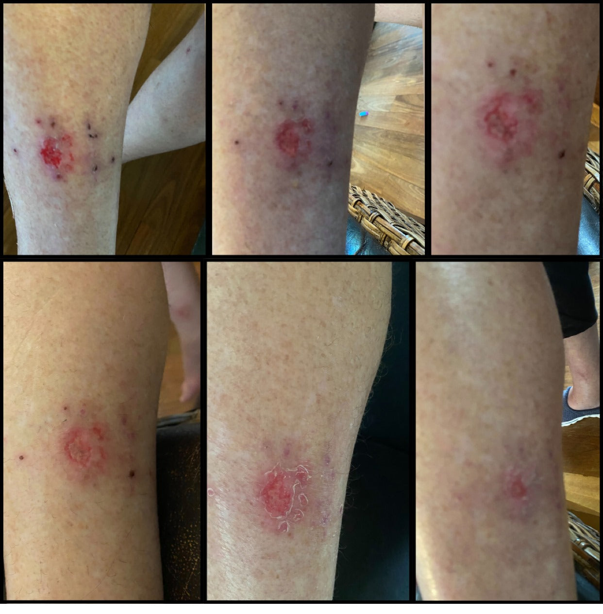 DermaGen Propolis Balm - with Antiseptic, Anti-inflammatory, and Antioxidant Properties