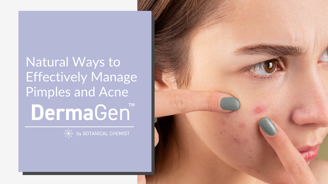 Natural Ways to Effectively Manage Pimples and Acne