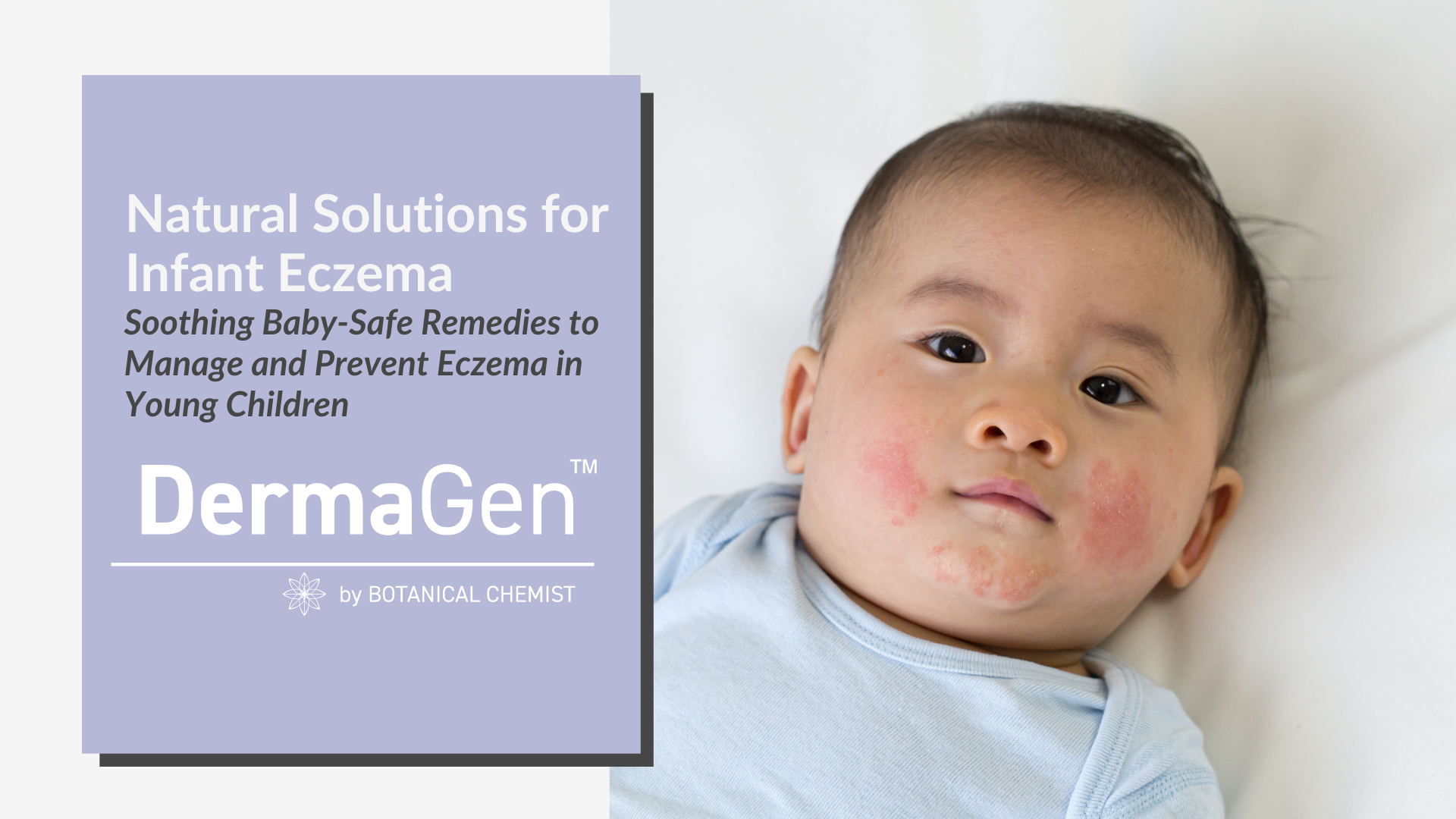 Soothing Baby-Safe Remedies to Manage and Prevent Eczema in Young Children