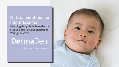 Natural Solutions for Infant Eczema