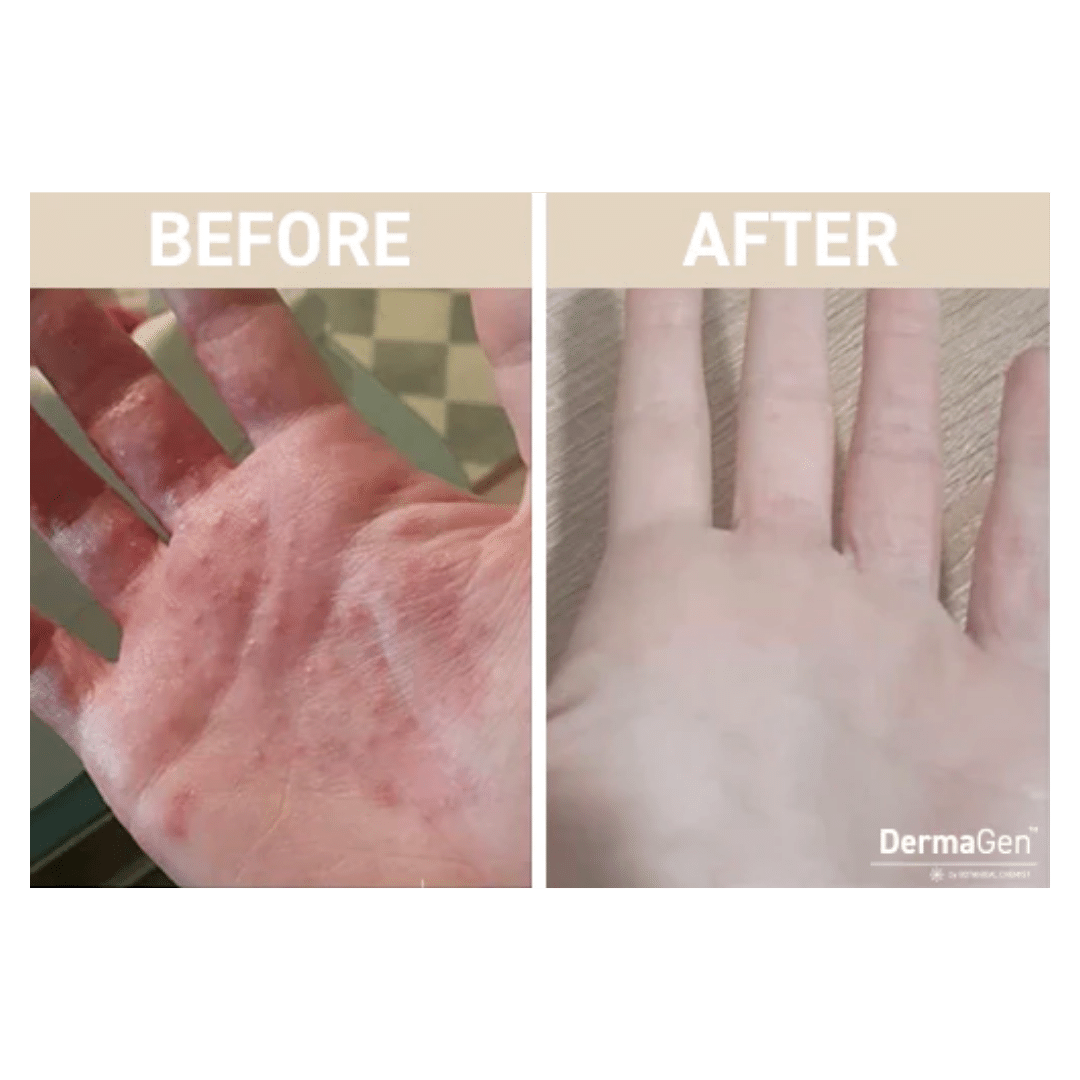 Customer Results – DermaGen by Botanical Chemist