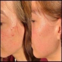 DERMAGEN Lotion DermaGen Skin Radiance Lotion
