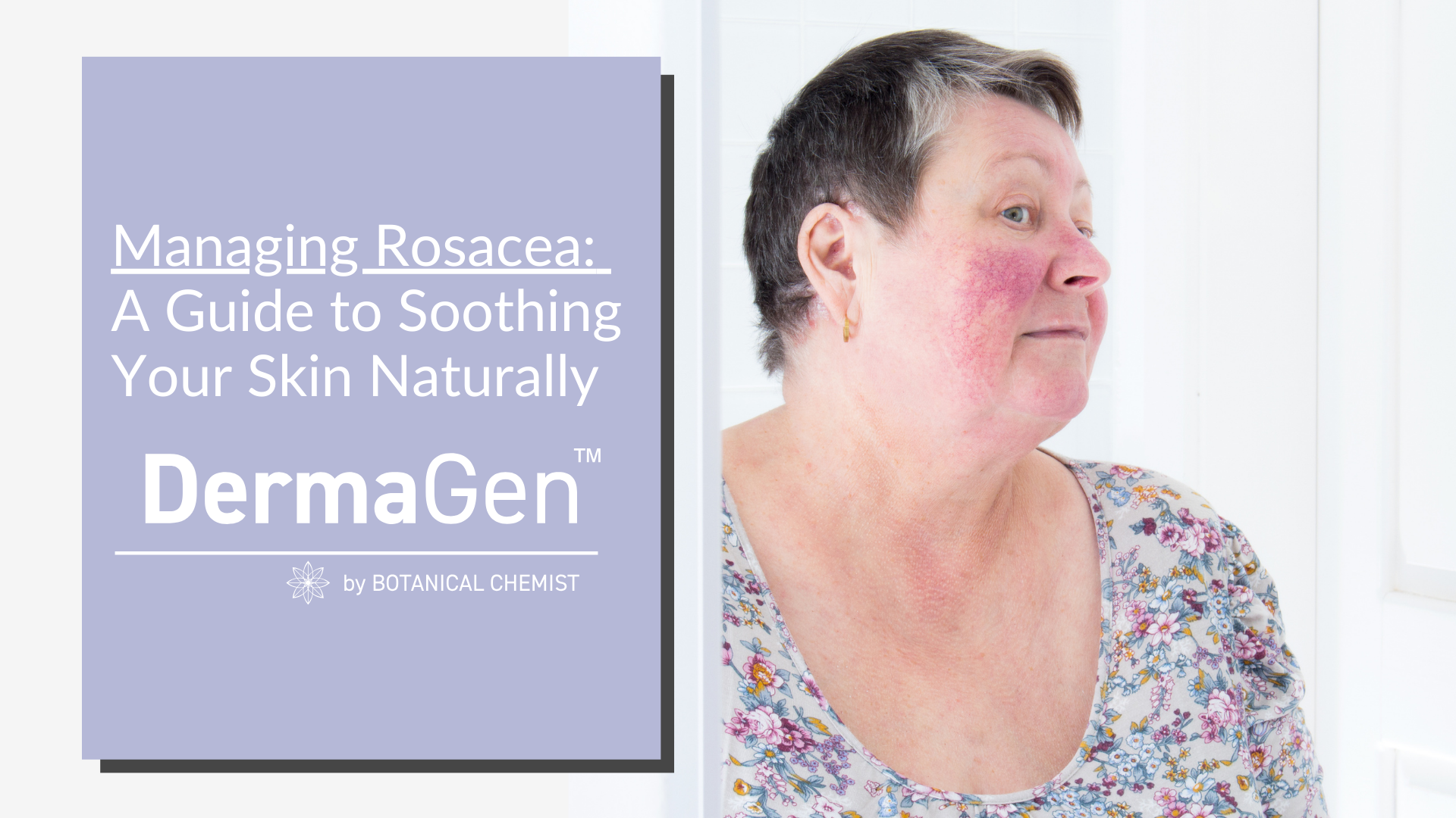 Rosacea: Understanding and Managing the Redness – DermaGen by Botanical 