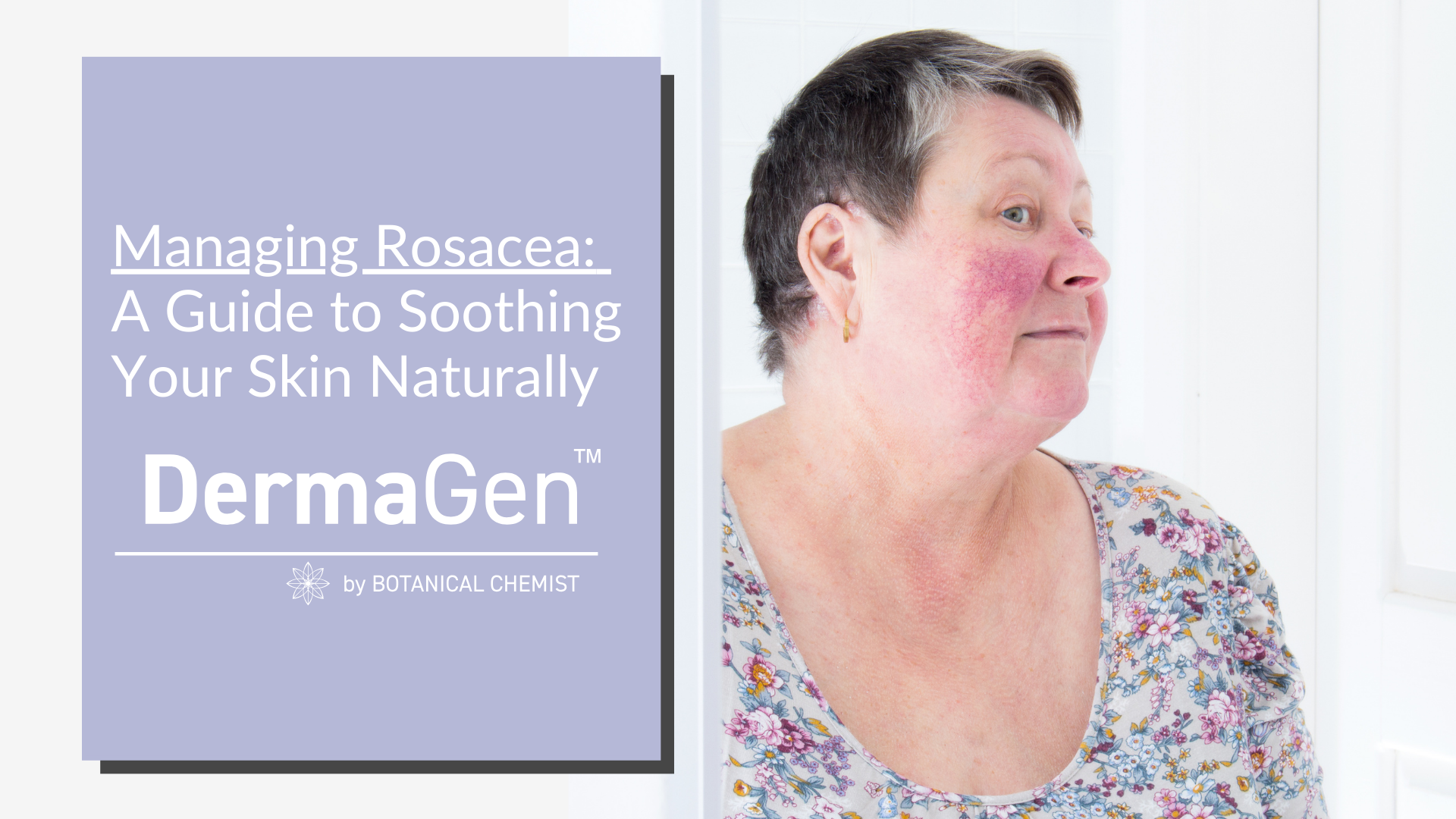 Rosacea: Understanding and Managing the Redness – DermaGen by Botanical