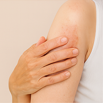 Eczema & Dermatitis Relief →