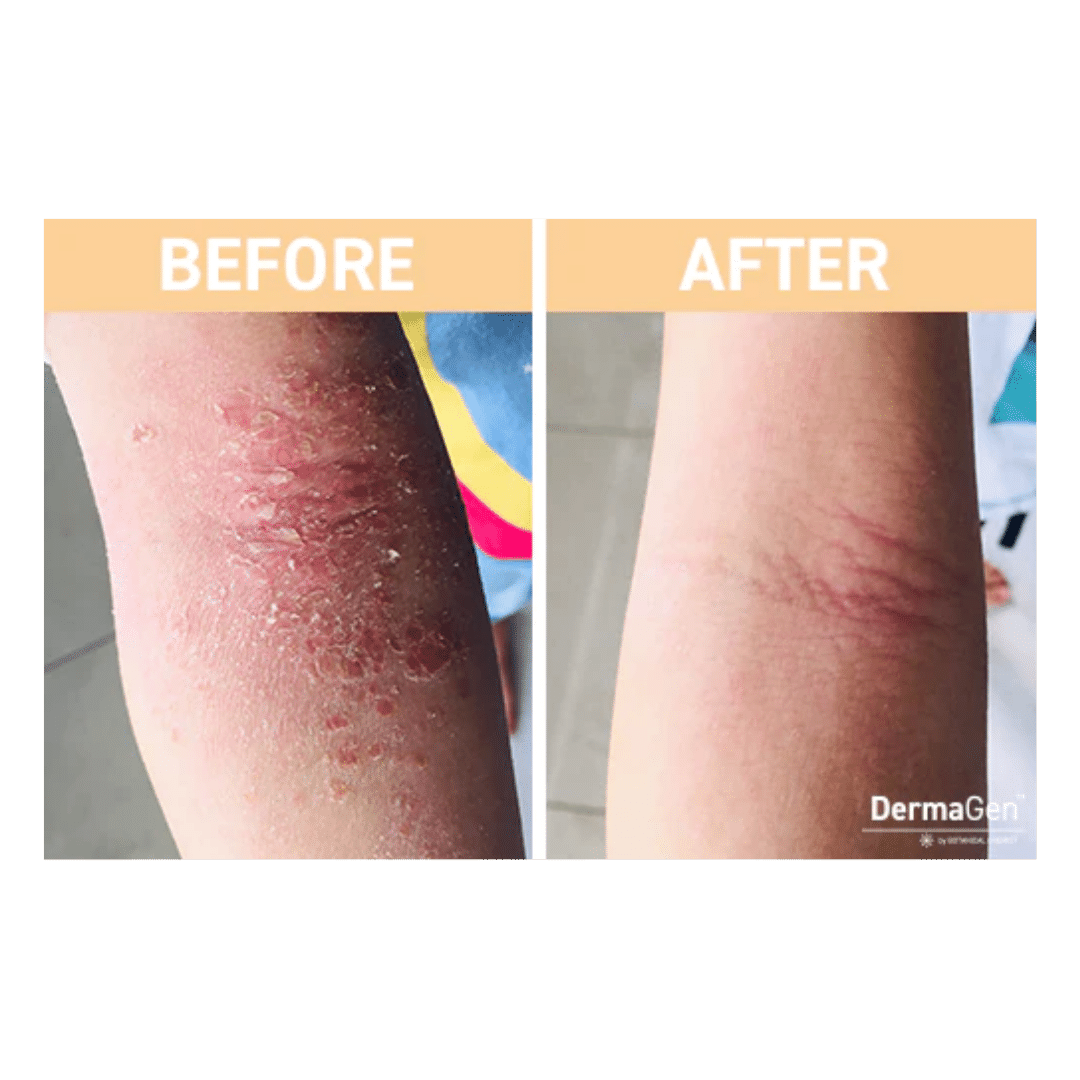 Customer Results – DermaGen by Botanical Chemist