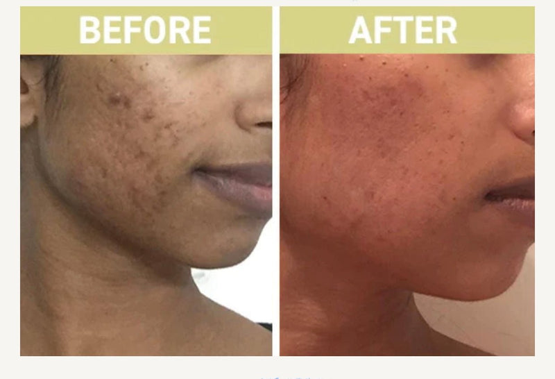 DERMAGEN Pack DermaGen Sun-damaged & Breakouts Duo