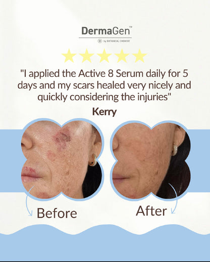 DERMAGEN Serum DermaGen Active 8 Serum